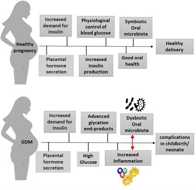 The oral microbiota and gestational diabetes mellitus